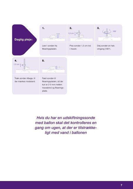 Den praktiske side af sondemad i hjemmet - Nutricia