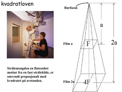 Konvensjonell røntgen --'røntgenbilder'--