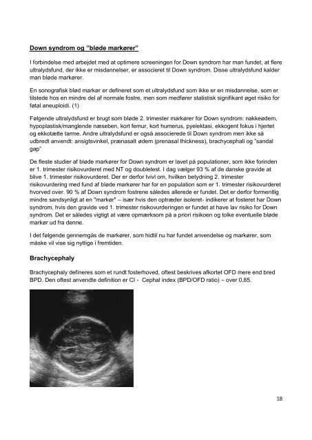 Risikovurdering i 2. trimester vedr. Downs syndrom - DFMS