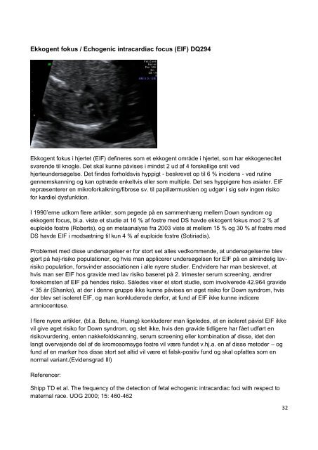 Risikovurdering i 2. trimester vedr. Downs syndrom - DFMS