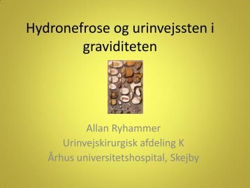 Hydronefrose og urinvejssten i graviditeten