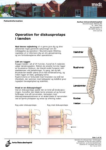 Operation for diskusprolaps i lænden - Aarhus Universitetshospital