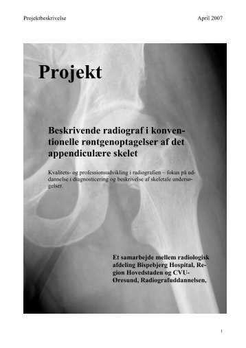 ent projektbeskrivelsen - Bispebjerg Hospital