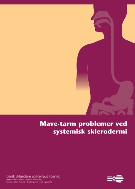 Mave-tarm problemer ved systemisk skle ro dermi