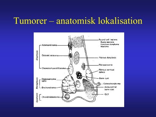 Tumore 2013 - MRprofessor.dk