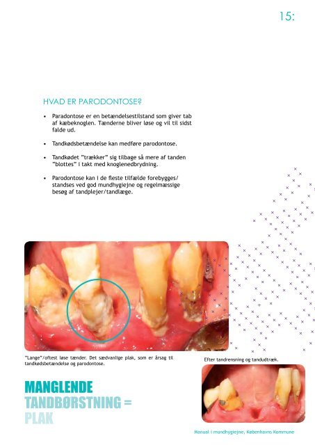 MANUAL I MUNDHYGIEJNE - Voksentandplejen