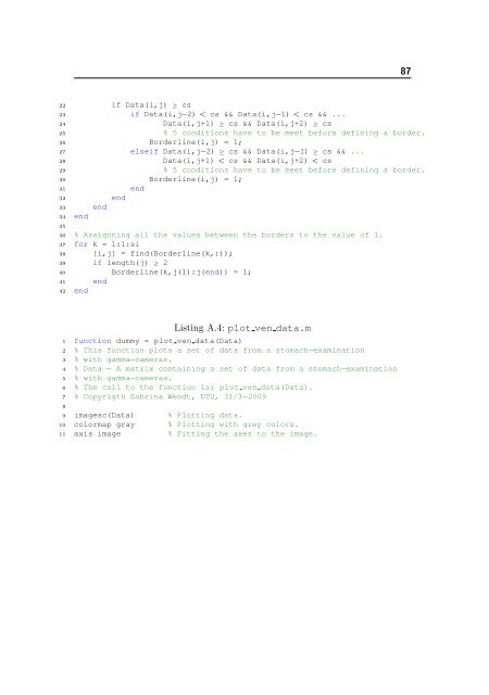 Matematisk Model for Mavesækkens Tømning - Danmarks Tekniske ...