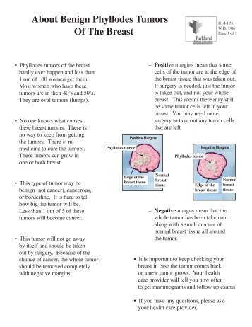 About Benign Phyllodes Tumors Of The Breast - Parkland Health ...