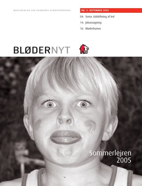 BløderNyt 3 05 05239-142 - Danmarks Bløderforening.