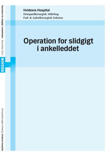 Operation for slidgigt i ankelleddet