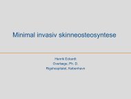 Skinneosteosyntese 2: Interne fixatorer, minimal invasiv teknik