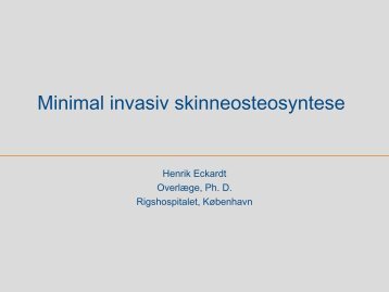 Skinneosteosyntese 2: Interne fixatorer, minimal invasiv teknik