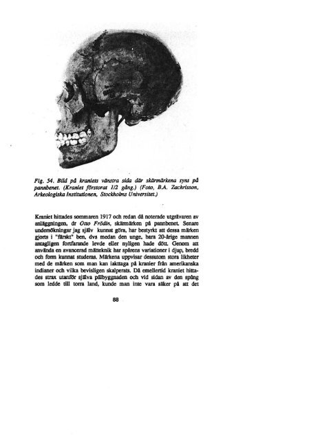 OSTEOLOGI BENENS VITTNESBÖRD