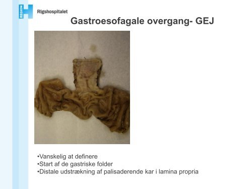 Øsofagus' og ventriklens sygdomme - Gastro.patologi.org