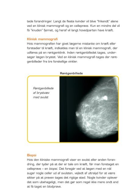 Mammografi Undersøgelse for brystkræft - Kræftens Bekæmpelse