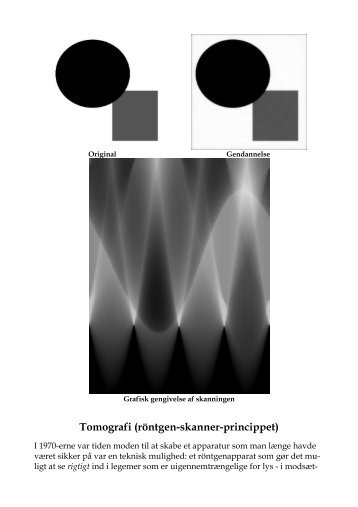 Tomografi (röntgen-skanner-princippet)