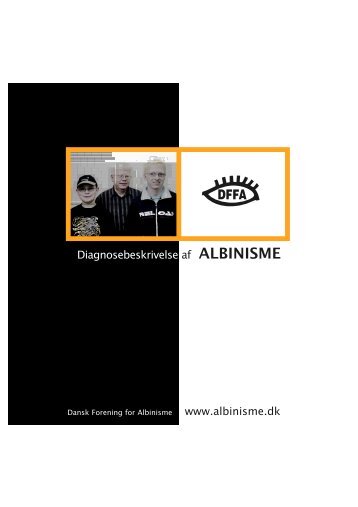 informationshæfte - Dansk forening for Albinisme