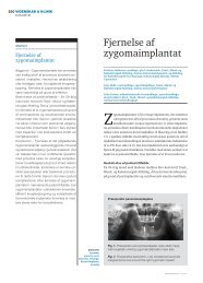 Fjernelse af zygomaimplantat - Odontologisk Institut - Aarhus ...