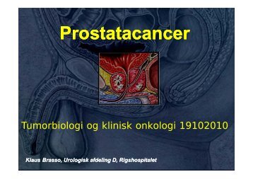 P t t P t t Prostatacancer