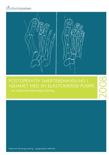 en medicinsk teknologivurdering – den fulde rapport (pdf)