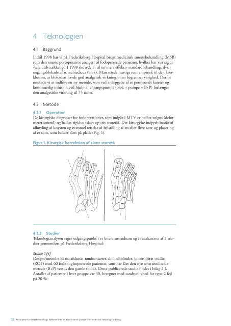 en medicinsk teknologivurdering – den fulde rapport (pdf)