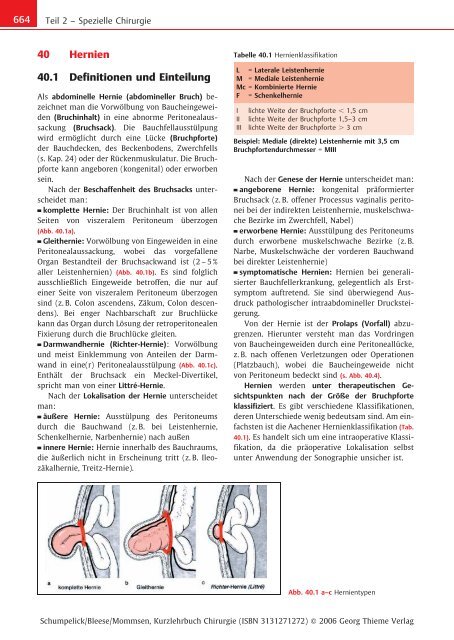 40 Hernien 40.1 Definitionen und Einteilung