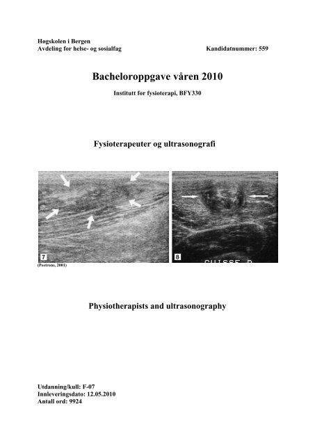 Bacheloroppgave fysioterapi Bacheloroppgave fysioterapi