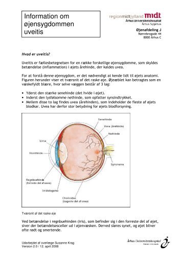 Information om øjensygdommen uveitis