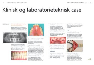 Klinisk og laboratorieteknisk case - AR Dental
