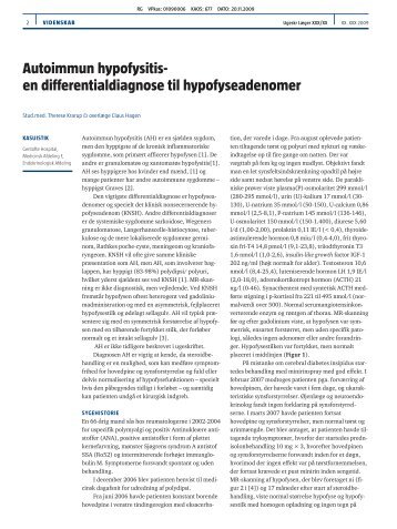 Autoimmun hypofysitis- en differentialdiagnose til hypofyseadenomer