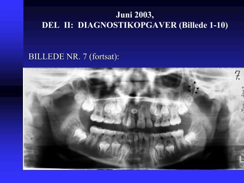 Juni 2003, DEL I: FLERVALGSOPGAVER (1-10) 1. Terrestrisk ...