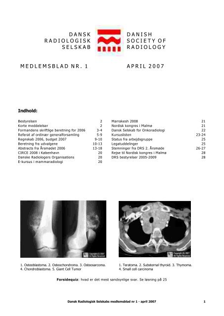 Medlemsblad nr. 1 April 2007 - Dansk Radiologisk Selskab