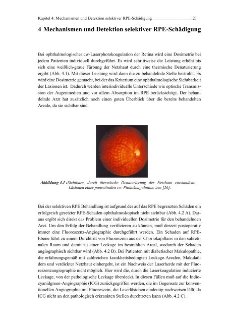 Mechanismen und On-line Dosimetrie bei selektiver RPE Therapie