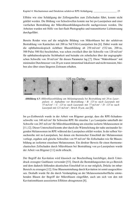 Mechanismen und On-line Dosimetrie bei selektiver RPE Therapie