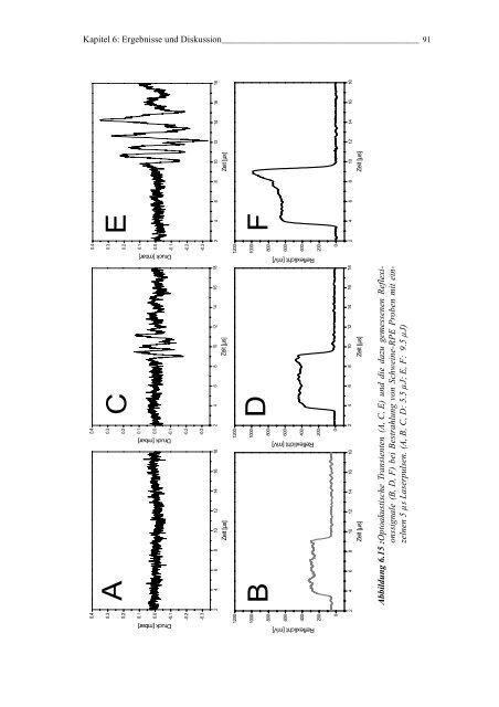 Mechanismen und On-line Dosimetrie bei selektiver RPE Therapie