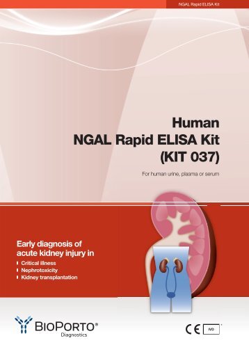 Human NGAL Rapid ELISA Kit (KIT 037)