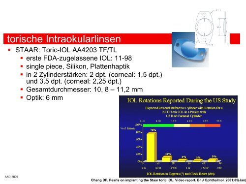 Astigmatismuskorrektur: torische IOL