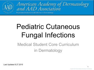 Pediatric Cutaneous Fungal Infections - Dermatology