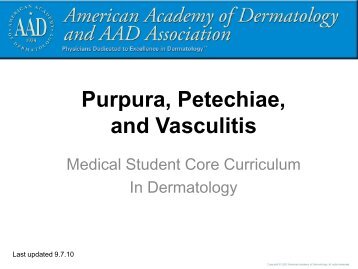 Purpura, Petechiae, and Vasculitis - Dermatology