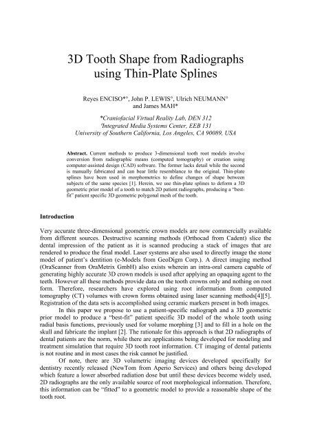 3D Tooth Shape from Radiographs using Thin-Plate Splines