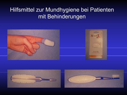 Problematik der Parodontalbehandlung bei Patienten mit ...