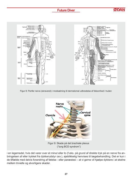 PNEUMOTHORAX OG DENS KONSKVENSER. DAN ... - DAN Europe