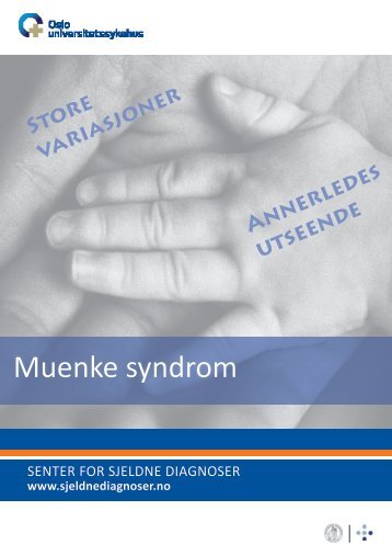 Muenke syndrom (pdf) - Senter for sjeldne diagnoser