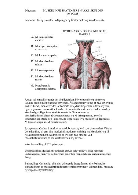 Genoptræning af skulder nakke parti.pdf - Helbreds Center Danmark