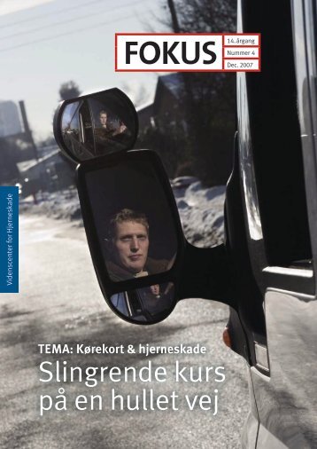 4 Slingrende kurs på en hullet vej - Servicestyrelsen
