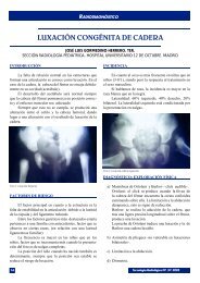 luxación congénita de cadera - AETR, Asociación Española ...
