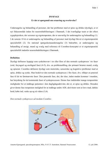 Side 1 DYSFAGI Er det et spørgsmål om ernæring og overlevelse ...