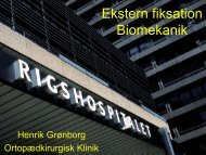 Ekstern fiksation biomekanik