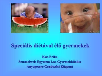 A fenilketonúria (PKU) dietétikai kezelése