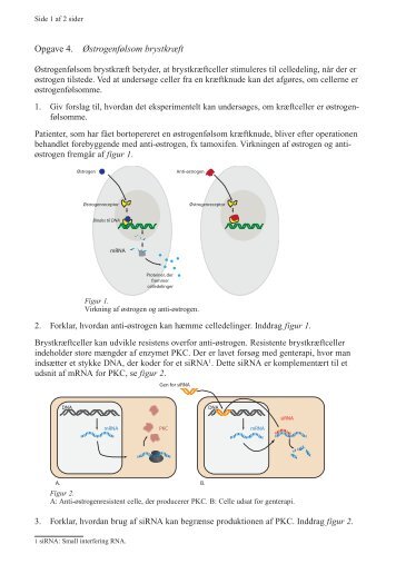 Opgave 4. Østrogenfølsom brystkræft